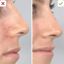 Mediashop.tv Körperpflege & Hygiene-Derma Suction Vakuum-Hautreiniger
