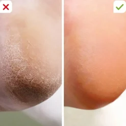 Keine Körperpflege & Hygiene|Kosmetik-Footlogix Fußpflegekombination für zu Hause