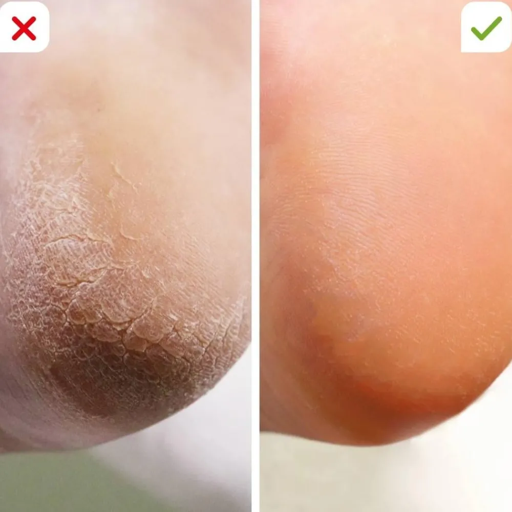 Keine Körperpflege & Hygiene|Kosmetik-Footlogix Fußpflegekombination für zu Hause