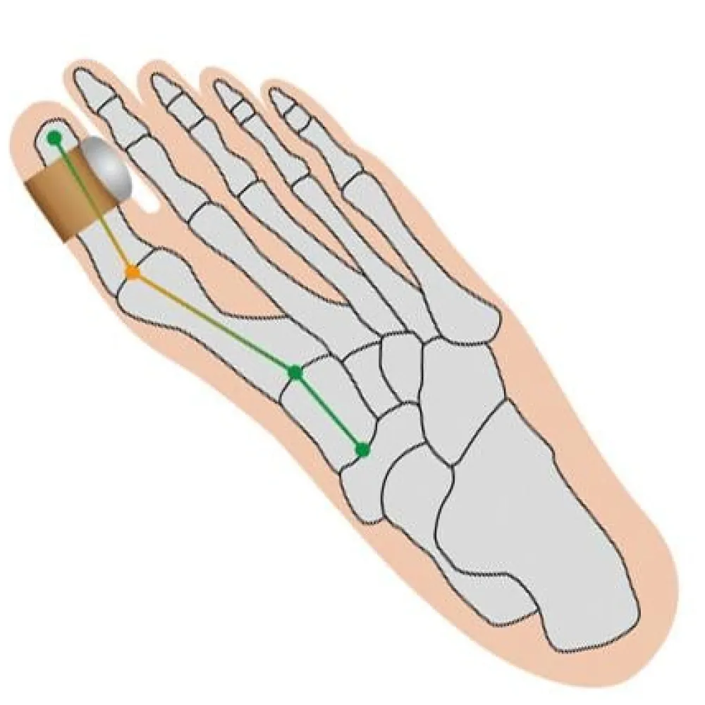Sonstiges Gesundheit & Wohlbefinden-Hallux Softkissen 2er-Set