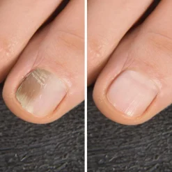 Keine Körperpflege & Hygiene-Mega-Spar-Set IZA Effect Anti Fuß- & Nagelpilz Spray 2+2 + IZA Fresh
